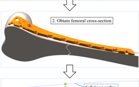 手术机器人的“眼睛”与“记忆”：动作捕捉赋能高精度骨科植入新范式